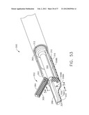 ULTRASONIC SURGICAL INSTRUMENT BLADES diagram and image