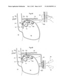 APPARATUS FOR TREATING GERD diagram and image