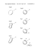 APPARATUS FOR TREATING GERD diagram and image