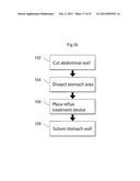 APPARATUS FOR TREATING GERD diagram and image