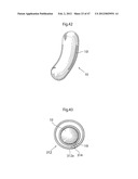 APPARATUS FOR TREATING GERD diagram and image