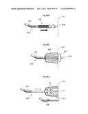 APPARATUS FOR TREATING GERD diagram and image