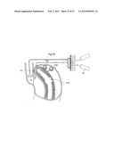 APPARATUS FOR TREATING GERD diagram and image