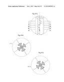 APPARATUS FOR TREATING GERD diagram and image