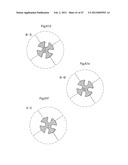 APPARATUS FOR TREATING GERD diagram and image