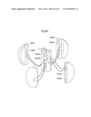 APPARATUS FOR TREATING GERD diagram and image