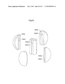 APPARATUS FOR TREATING GERD diagram and image