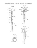 APPARATUS FOR TREATING GERD diagram and image