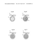 APPARATUS FOR TREATING GERD diagram and image