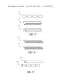 METHOD AND APPARATUS FOR IMPEDING MIGRATION OF AN IMPLANTED OCCLUSIVE     STRUCTURE diagram and image