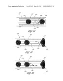 METHOD AND APPARATUS FOR IMPEDING MIGRATION OF AN IMPLANTED OCCLUSIVE     STRUCTURE diagram and image