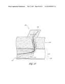 METHOD AND APPARATUS FOR IMPEDING MIGRATION OF AN IMPLANTED OCCLUSIVE     STRUCTURE diagram and image