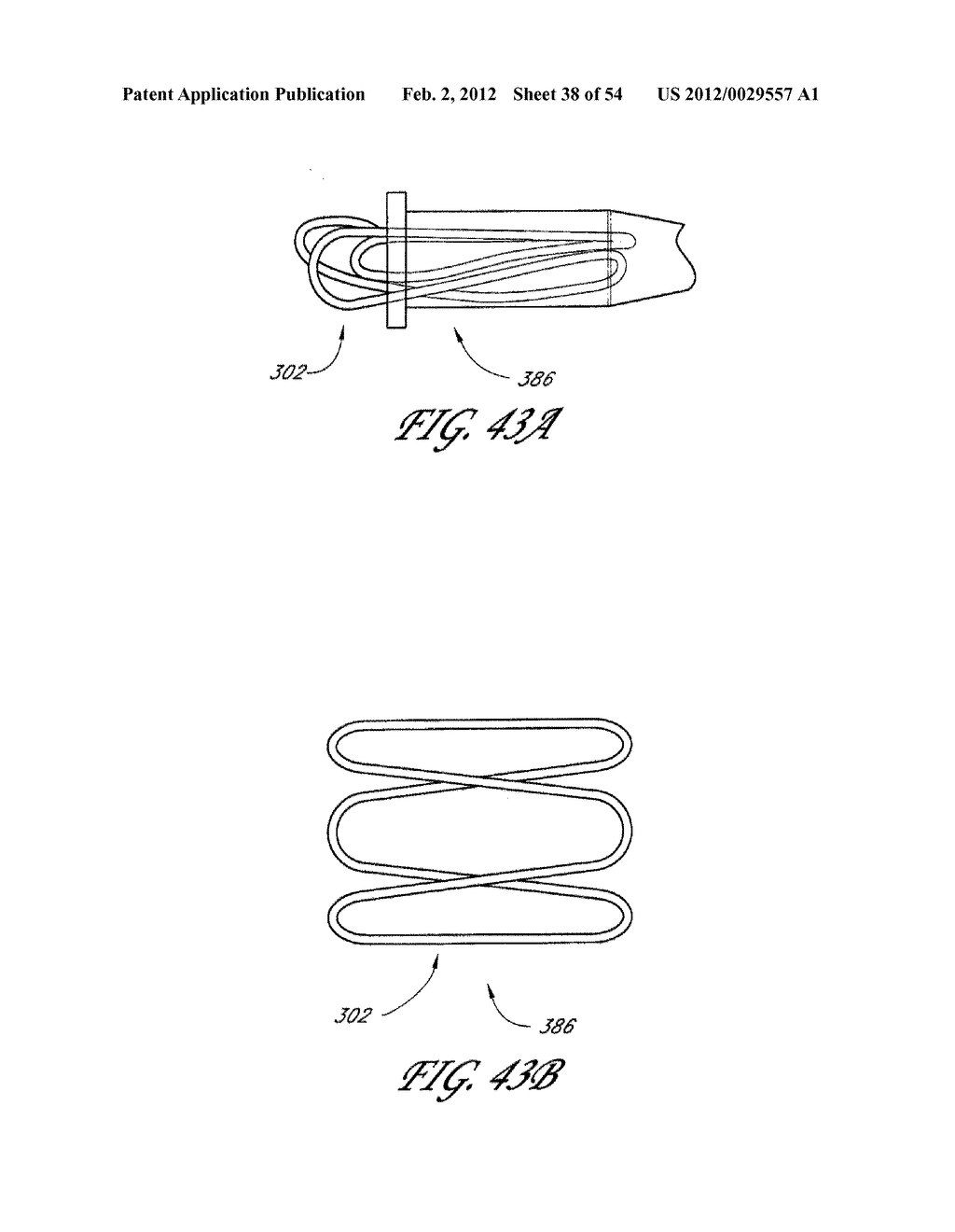 METHOD AND APPARATUS FOR IMPEDING MIGRATION OF AN IMPLANTED OCCLUSIVE     STRUCTURE - diagram, schematic, and image 39