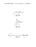 METHOD AND APPARATUS FOR IMPEDING MIGRATION OF AN IMPLANTED OCCLUSIVE     STRUCTURE diagram and image