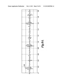 PULSE DETECTION APPARATUS, SOFTWARE, AND METHODS USING PATIENT     PHYSIOLOGICAL SIGNALS diagram and image