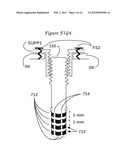 Method and means to adjust the positioning of stimulating neural and     muscular electrode diagram and image