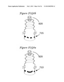 Method and means to adjust the positioning of stimulating neural and     muscular electrode diagram and image