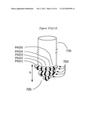 Method and means to adjust the positioning of stimulating neural and     muscular electrode diagram and image