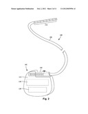 SYSTEMS AND METHODS FOR MAKING AND USING ELECTRICAL STIMULATION SYSTEMS     HAVING MULTI-LEAD-ELEMENT LEAD BODIES diagram and image