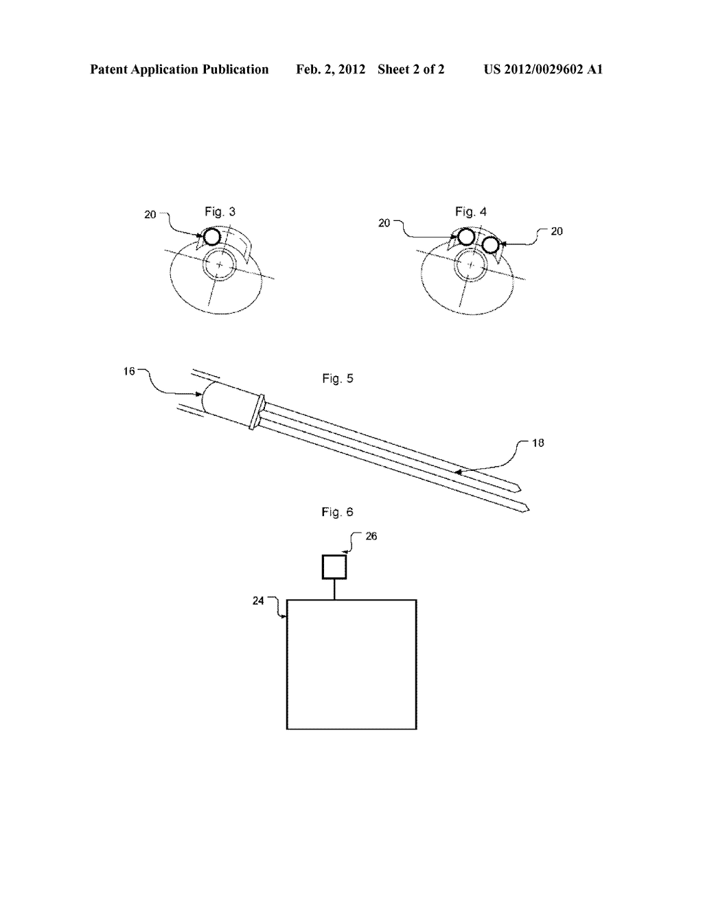 Method, Apparatus, and System for Treatment of Hemorrhoidal Disease Using     Negative Galvanism - diagram, schematic, and image 03