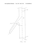 METHOD OF DELIVERING ADVANCED ENDOVASCULAR GRAFT diagram and image