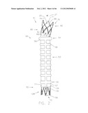 METHOD OF DELIVERING ADVANCED ENDOVASCULAR GRAFT diagram and image