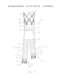 METHOD OF DELIVERING ADVANCED ENDOVASCULAR GRAFT diagram and image