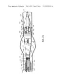 METHOD OF DELIVERING ADVANCED ENDOVASCULAR GRAFT diagram and image