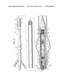 METHOD OF DELIVERING ADVANCED ENDOVASCULAR GRAFT diagram and image