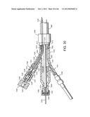 METHOD OF DELIVERING ADVANCED ENDOVASCULAR GRAFT diagram and image