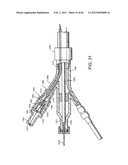 METHOD OF DELIVERING ADVANCED ENDOVASCULAR GRAFT diagram and image