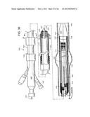 METHOD OF DELIVERING ADVANCED ENDOVASCULAR GRAFT diagram and image