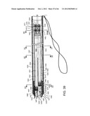 METHOD OF DELIVERING ADVANCED ENDOVASCULAR GRAFT diagram and image