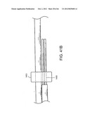 METHOD OF DELIVERING ADVANCED ENDOVASCULAR GRAFT diagram and image