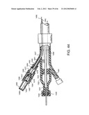 METHOD OF DELIVERING ADVANCED ENDOVASCULAR GRAFT diagram and image