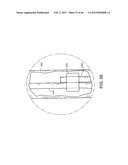 METHOD OF DELIVERING ADVANCED ENDOVASCULAR GRAFT diagram and image