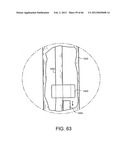 METHOD OF DELIVERING ADVANCED ENDOVASCULAR GRAFT diagram and image