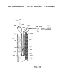 METHOD OF DELIVERING ADVANCED ENDOVASCULAR GRAFT diagram and image