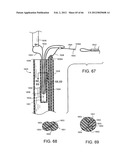 METHOD OF DELIVERING ADVANCED ENDOVASCULAR GRAFT diagram and image