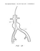 GRAFT DEPLOYMENT SYSTEM diagram and image