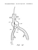 GRAFT DEPLOYMENT SYSTEM diagram and image