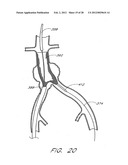 GRAFT DEPLOYMENT SYSTEM diagram and image