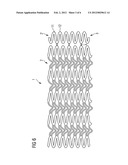 COVERED TOROID STENT AND METHODS OF MANUFACTURE diagram and image