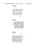 COVERED TOROID STENT AND METHODS OF MANUFACTURE diagram and image