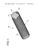 Stent-Graft with Bioabsorbable Structural Support diagram and image