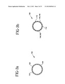 Stent-Graft with Bioabsorbable Structural Support diagram and image