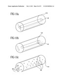 Stent-Graft with Bioabsorbable Structural Support diagram and image