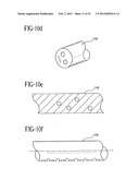 Stent-Graft with Bioabsorbable Structural Support diagram and image