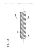 Stent-Graft with Bioabsorbable Structural Support diagram and image