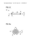 Stent-Graft with Bioabsorbable Structural Support diagram and image